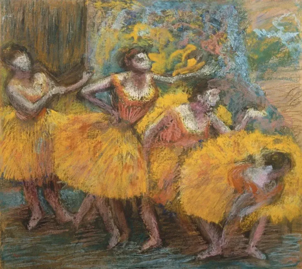 Degas - Bailarinas, afetado por doença retiniana